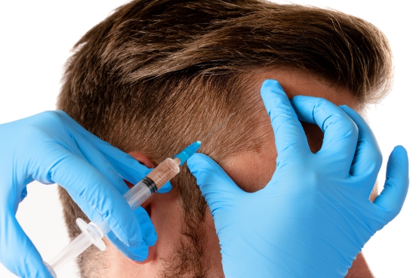 PRP treatment image 4